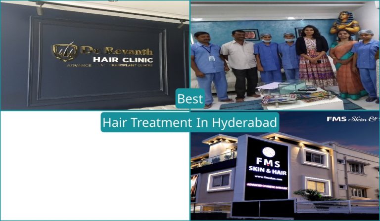 Best Hair Treatment In Hyderabad